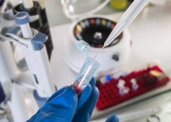 Alertan por casos de meningitis en pacientes que se sometieron a cirugías en Tamaulipas