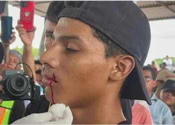 Ante negativa de otorgarles visas humanitarias, migrantes se cosen los labios como protesta en México
