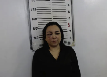 Borracha choca contra patrulla, lesiona a un policía