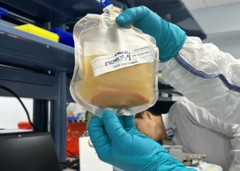 Empresa empieza ensayos clínicos con mini-higados desarrollados en pacientes humanos