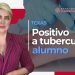 Positivo a tuberculosis alumno