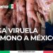 Llega viruela del mono a México!