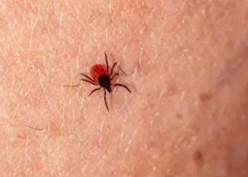 Dos casos de rickettsia ponen en alerta la salud pública en Altamira