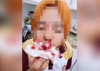Ataque a estudiante enciende alarmas en secundaria de Reynosa