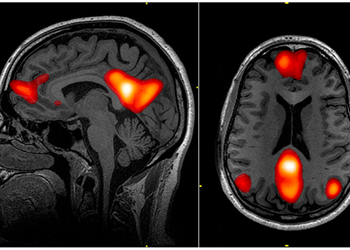 Cómo la vejez cambia la red cerebral