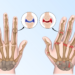 Ten cuidado con la artritis