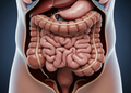 Así se previene el cáncer de colorrectal